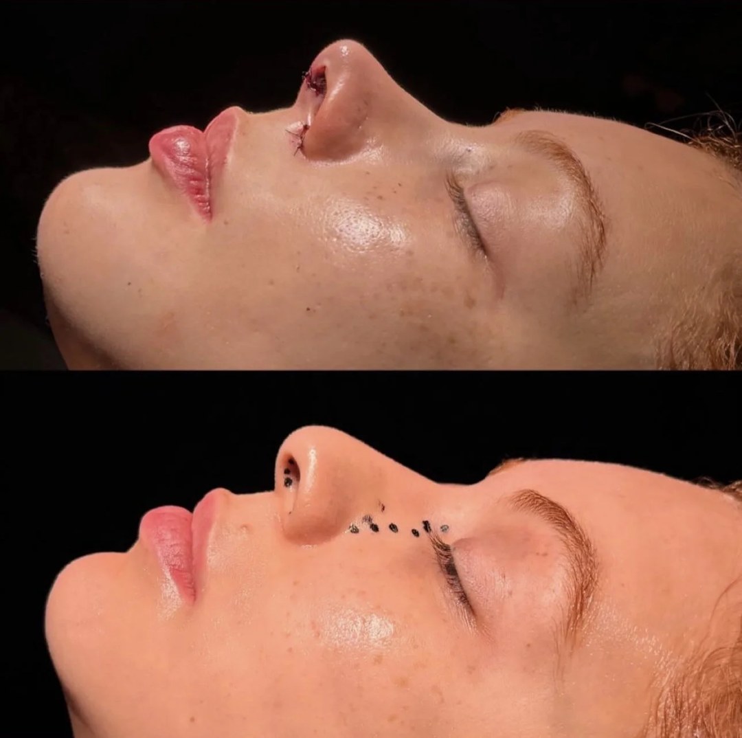 Galeria de resultados: antes e depois