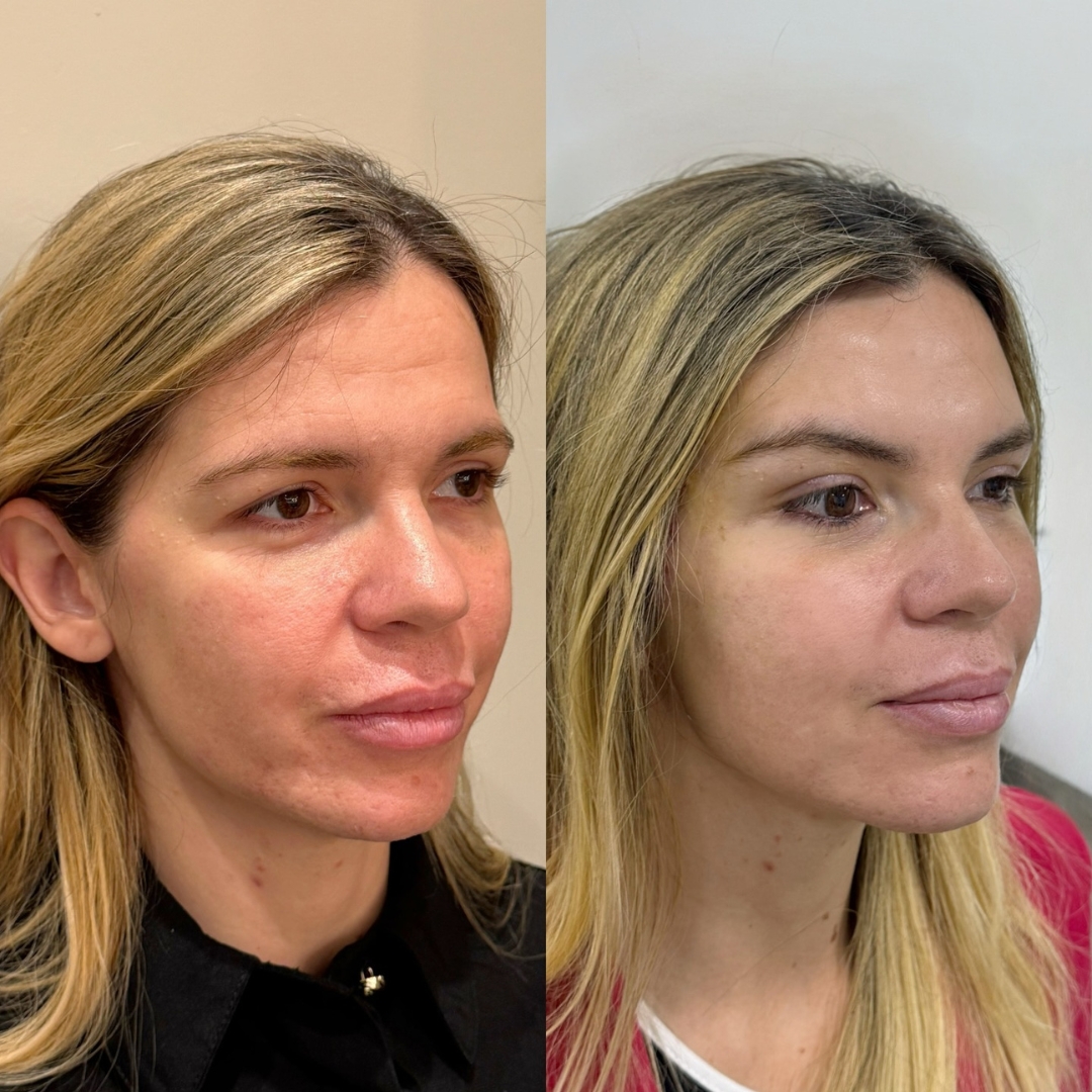 Galeria de resultados — antes e depois