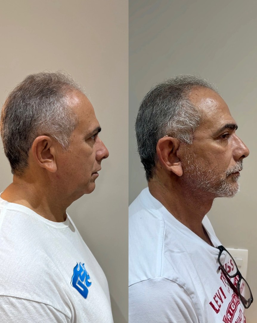 Galeria de resultados: antes e depois